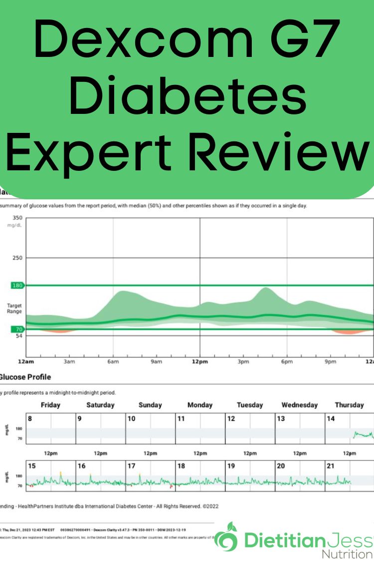 dexcom G7 expert review